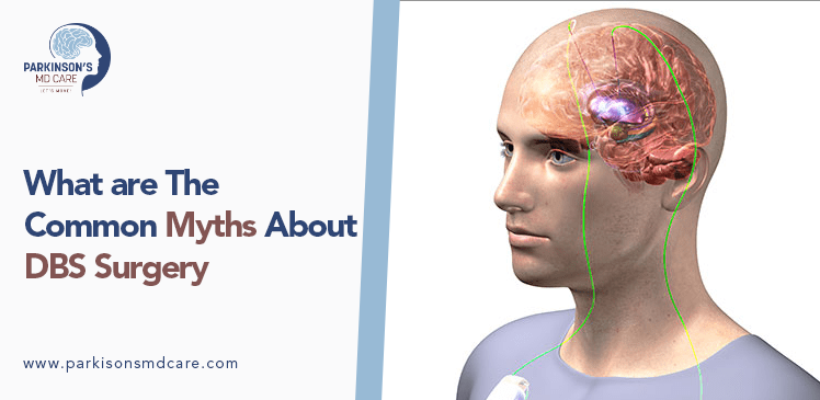 Common myths about DBS Surgery